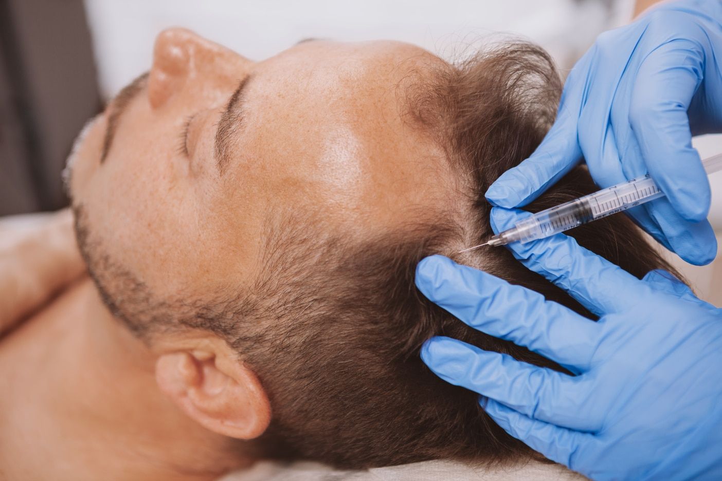 Clinicas capilares